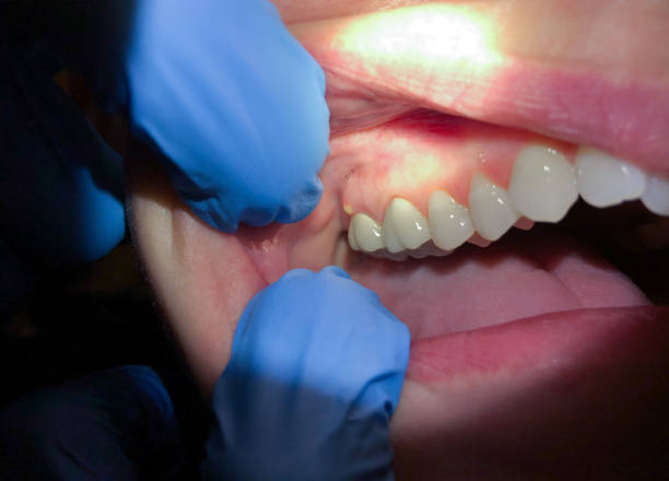 Best Emergency Cosmetic Dentistry in Marietta Alderwood, WA