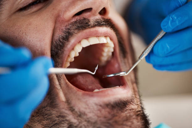 Best Mobile Emergency Dentist in Marietta Alderwood, WA